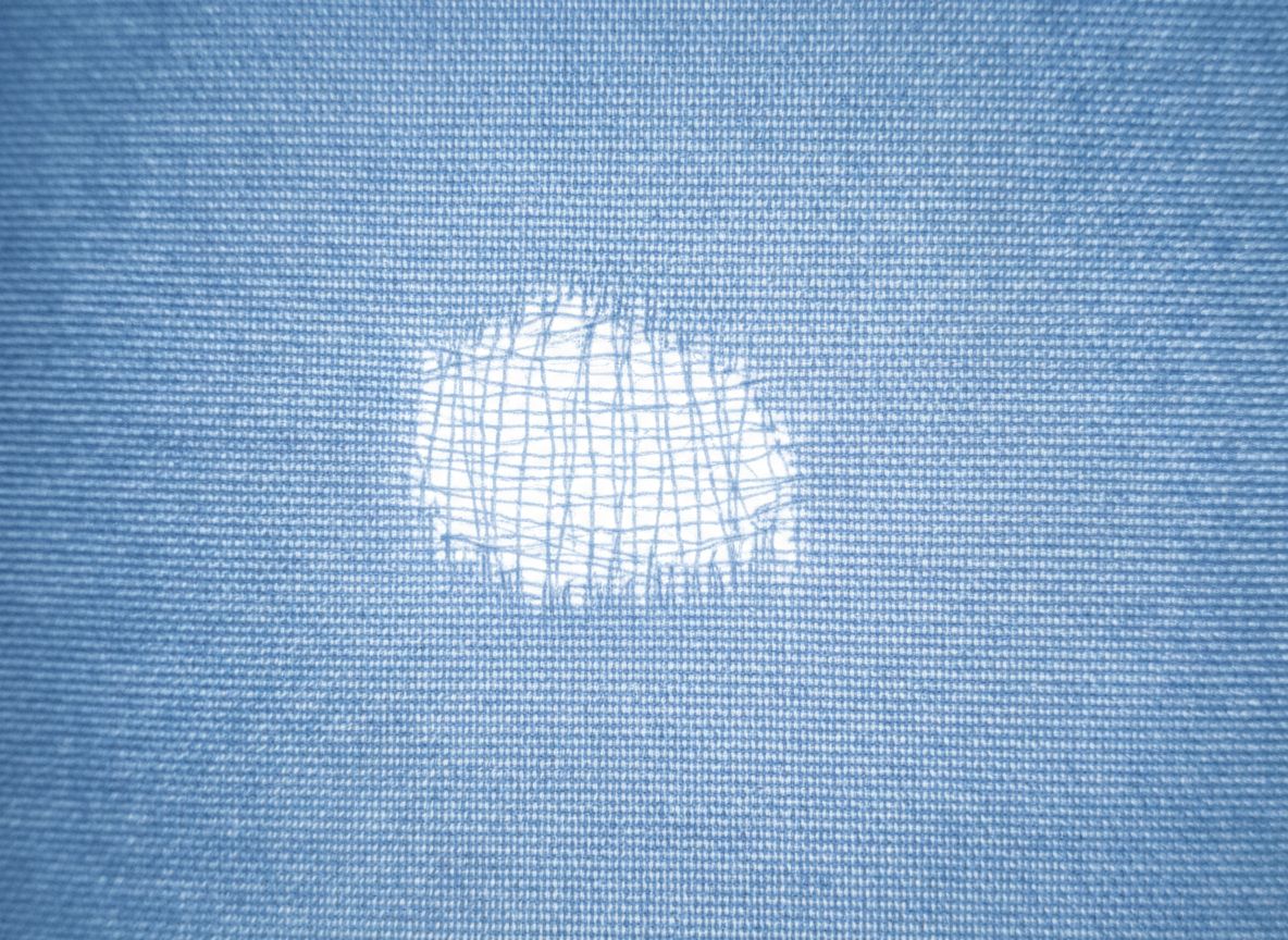Thin Places and Missing Yarn Fabric Defects 1